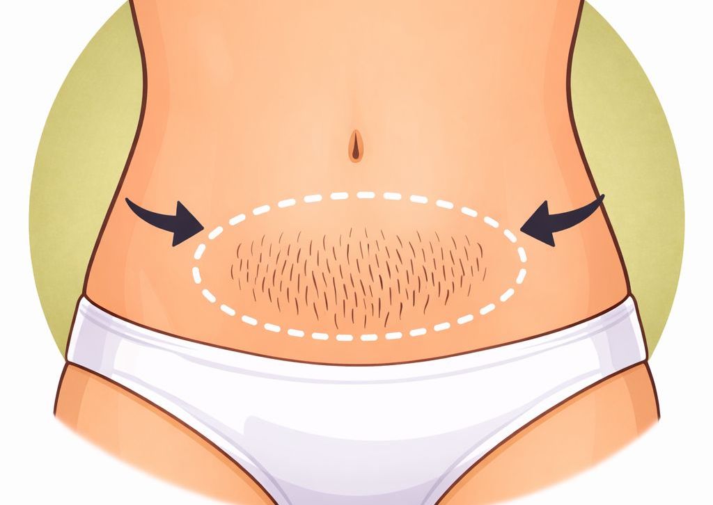 Stomach Strip