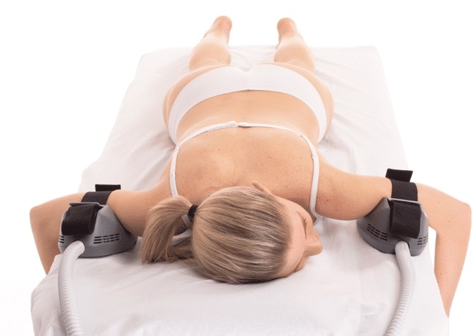 MF-SCULPT - UperArm 2 Pads