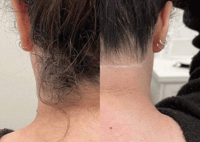 Women - Back Of the Neck 