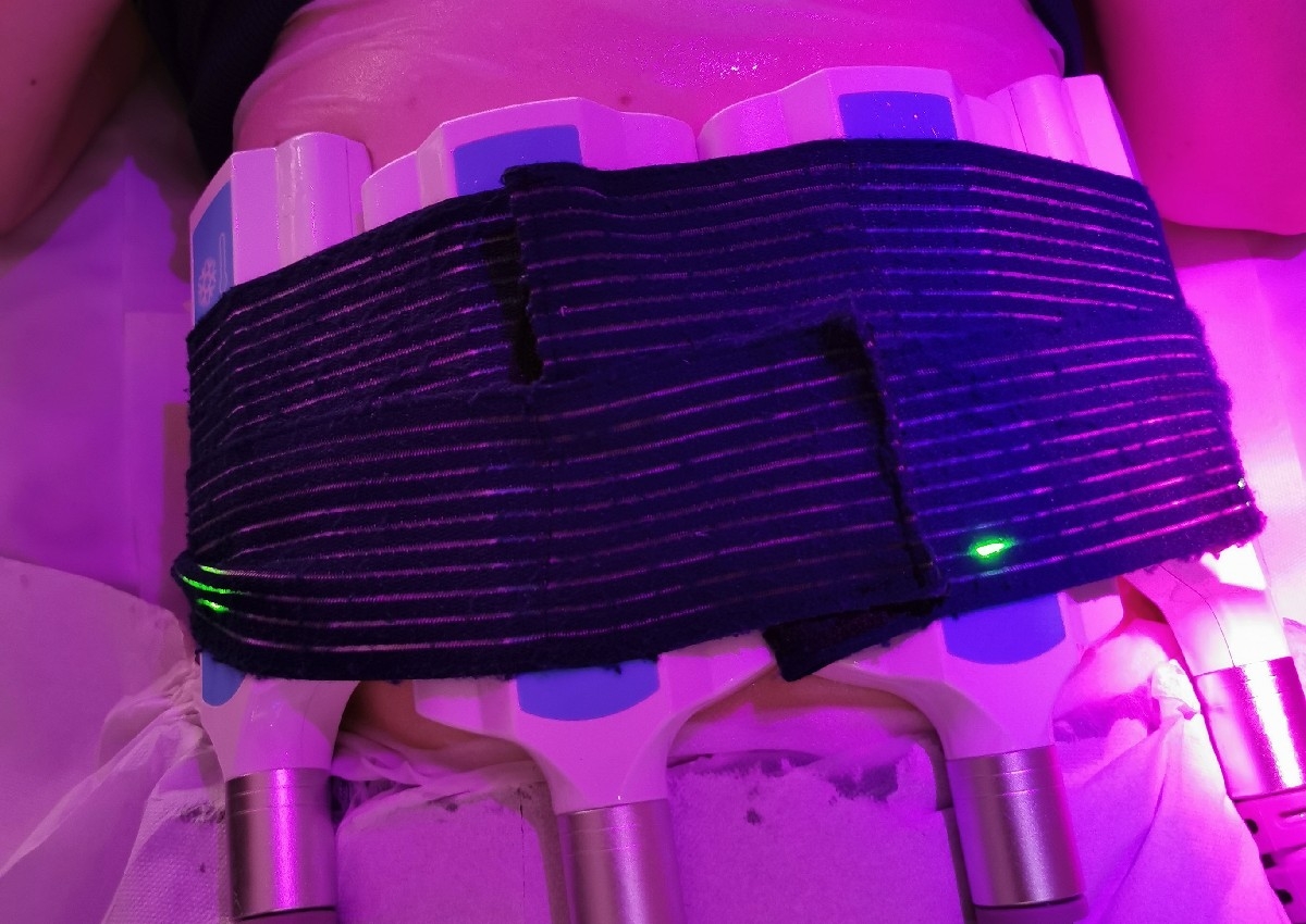 4 Pads Cryolipolisis 