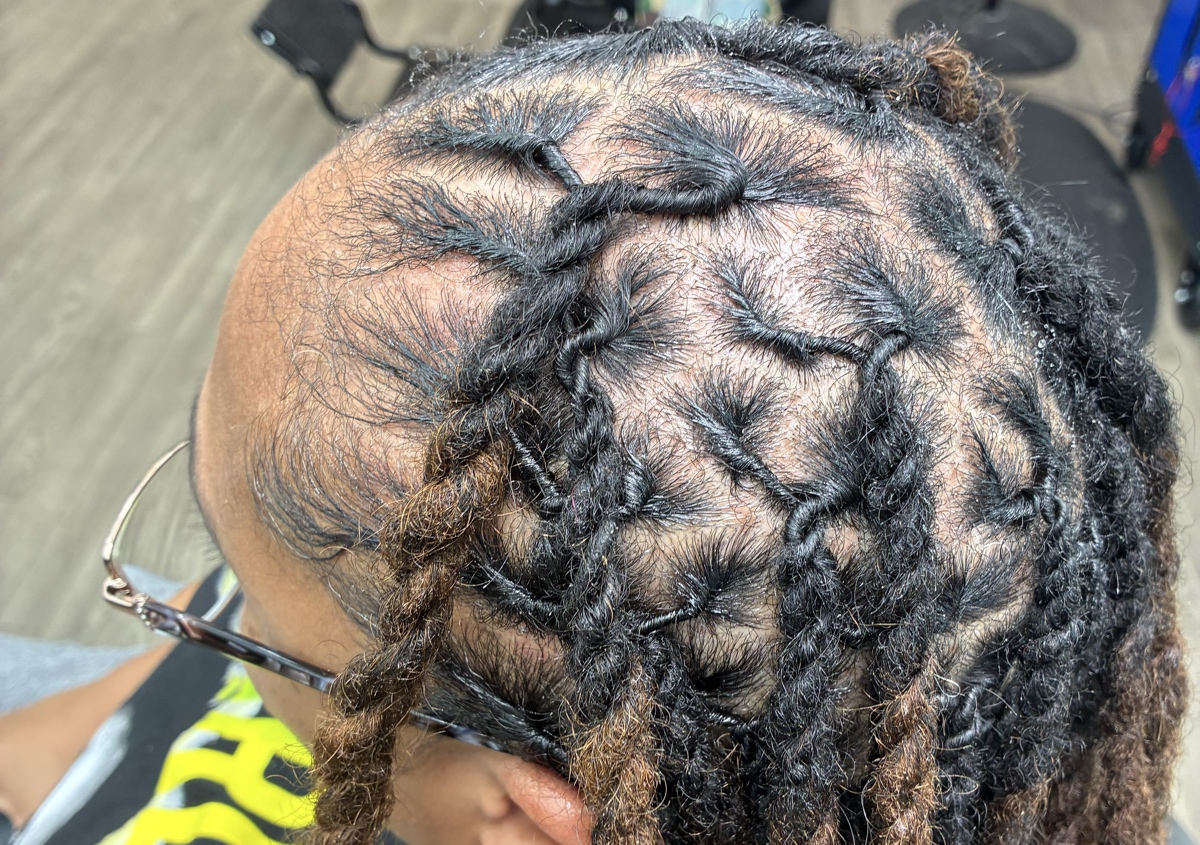 Loc maintenance (platinum) 
