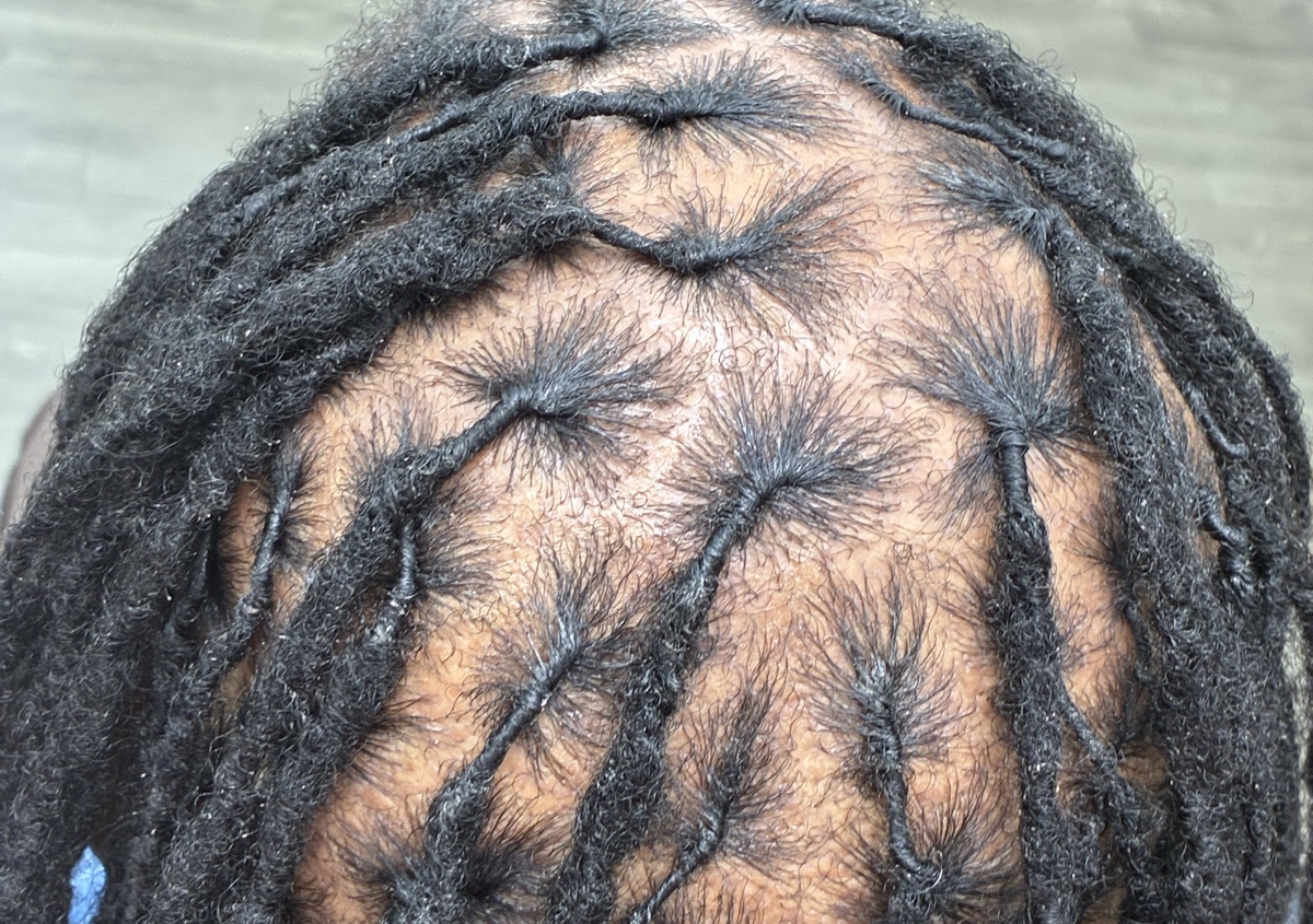 Retwist (basic) 