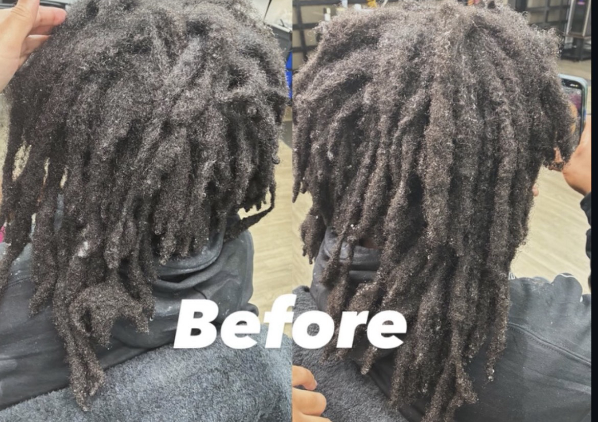 Loc reconstruction 