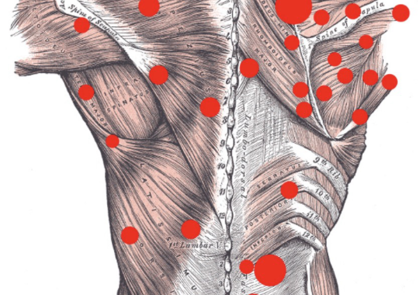 Trigger Point
