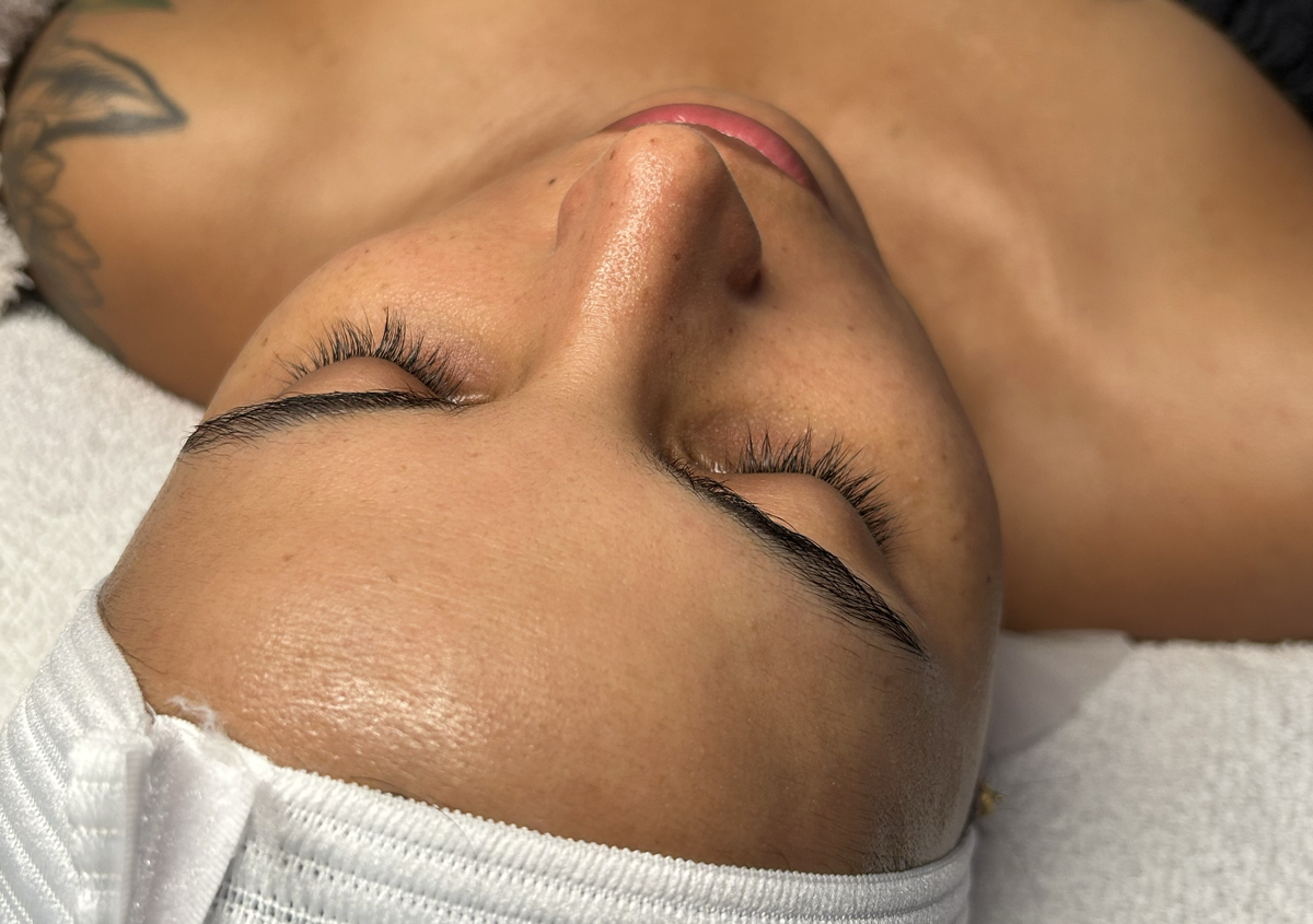 Peeling Suave - Renew Skin