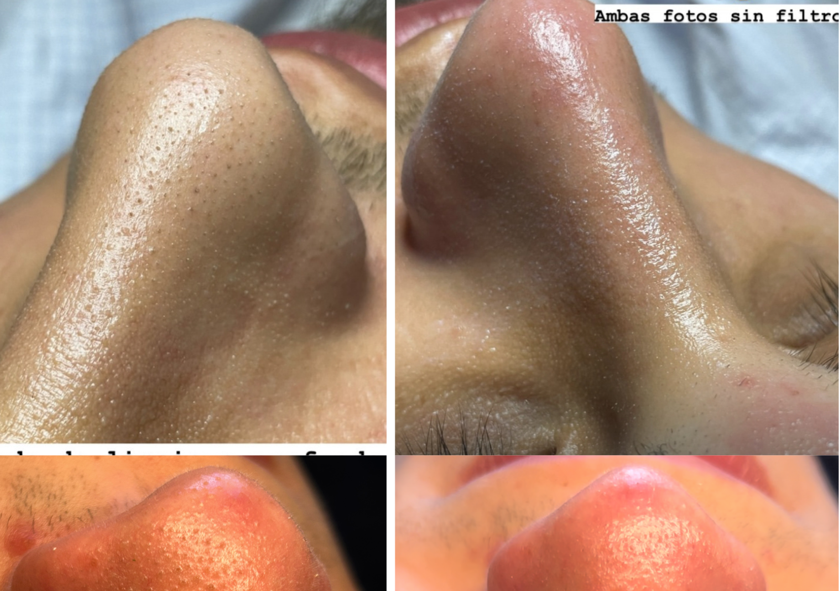 Black/Whitehead Protocol 👃🏼