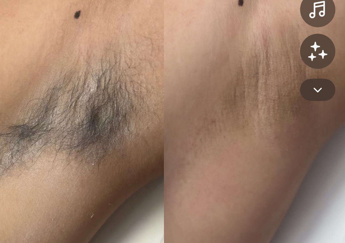 under arm