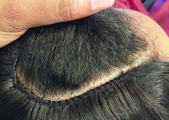✨ Sew-In Removal