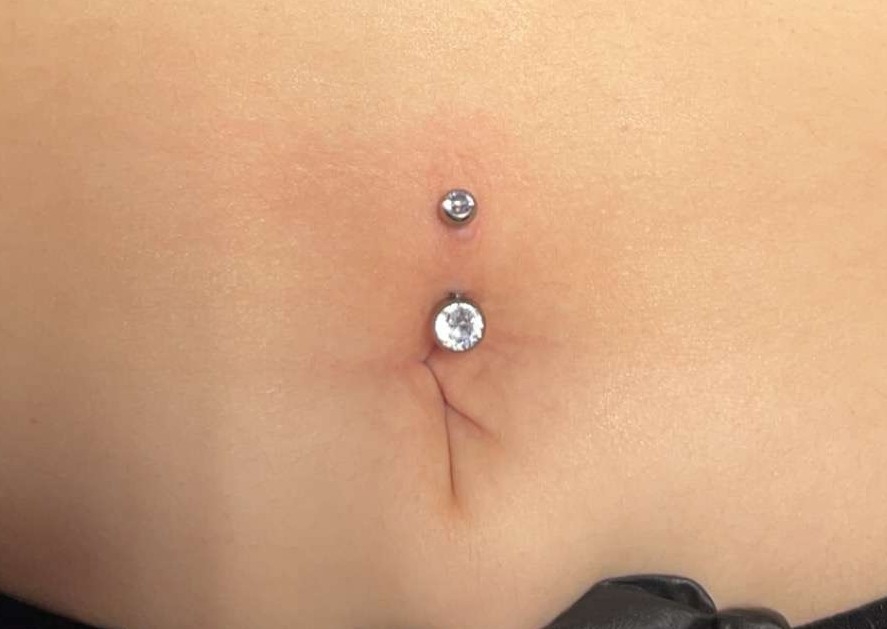 Navel