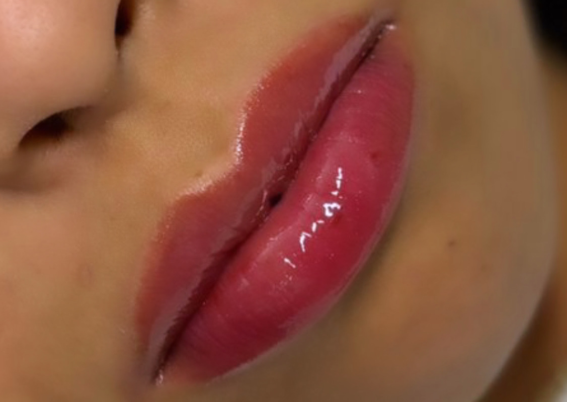 Hydra Lips