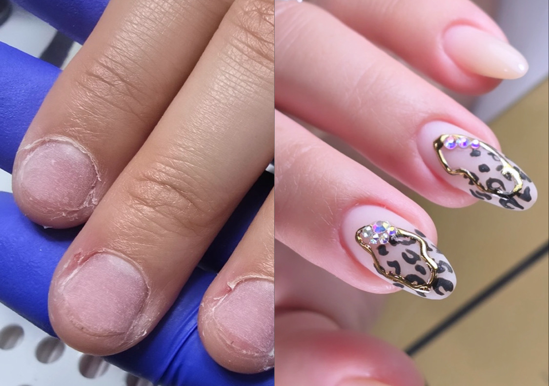 FULL SET (NAIL EXTENSIONS)