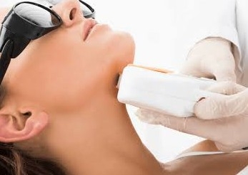 Mentón y mandíbula  ( Chin and Jawline) depilacion laser