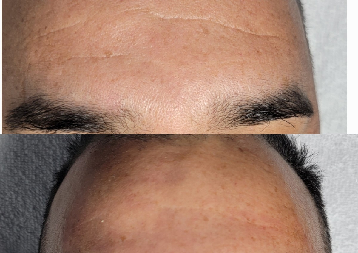 Tratamiento anti edad Mesosic ampolleta 