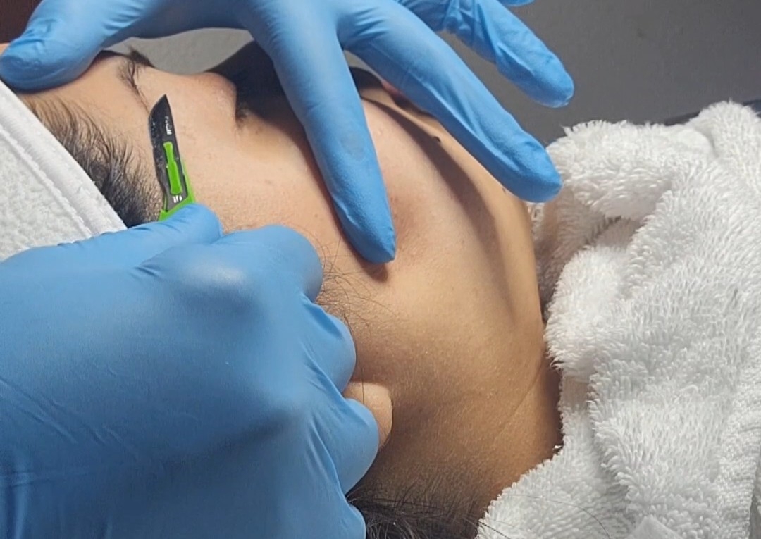 Limpieza profunda y Dermaplaning 