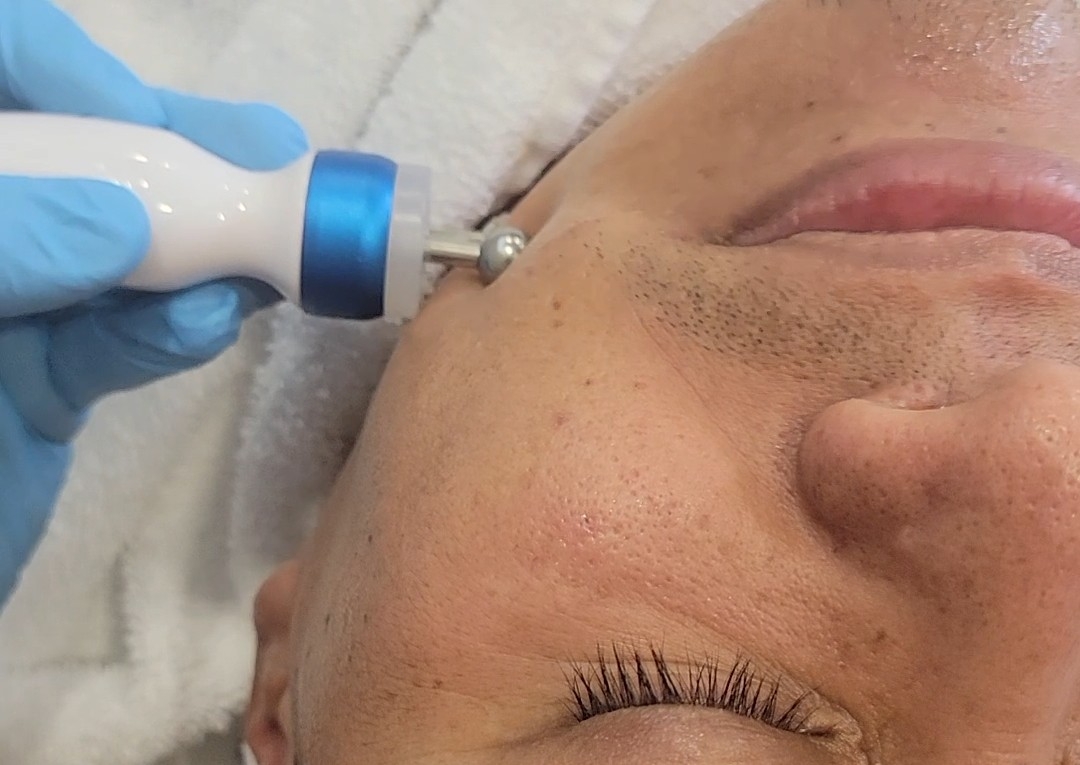 Microcorriente tensa y perfila.