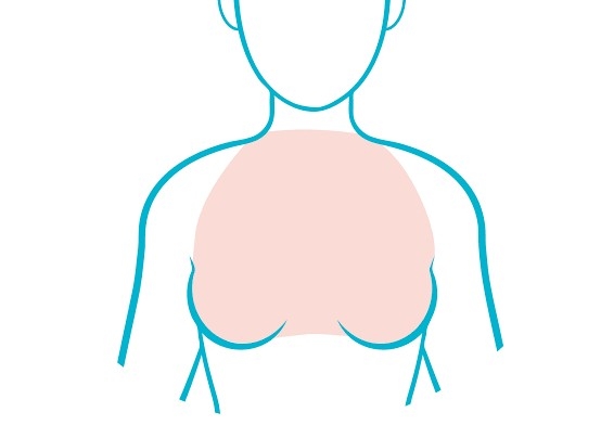 Pecho ( Chest) Depilacion laser 