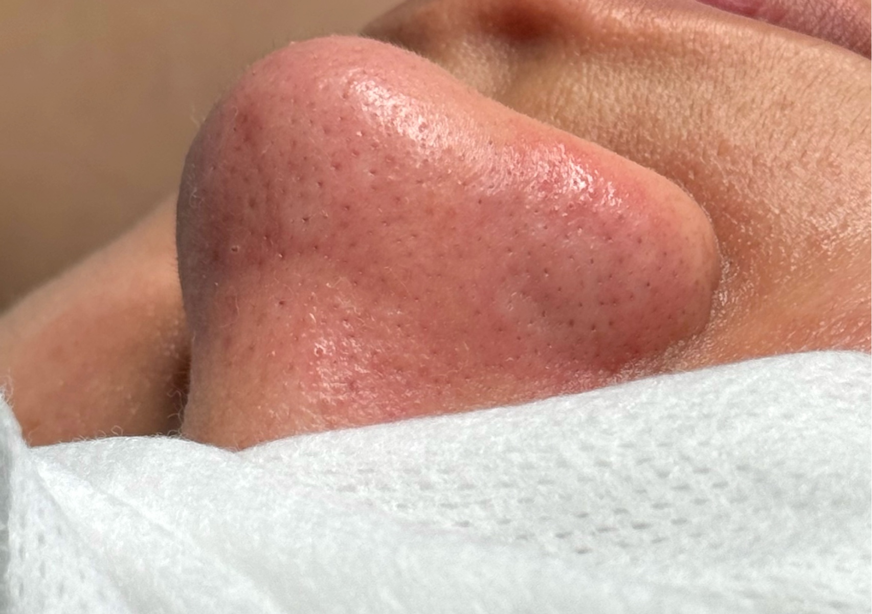 Deep Cleansing Facial