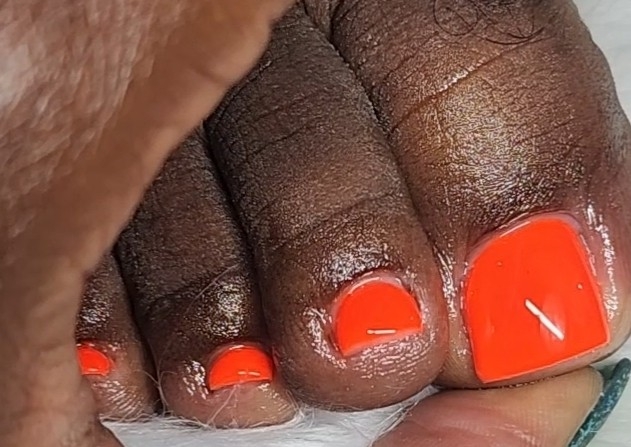 RubberBase (All Toes)