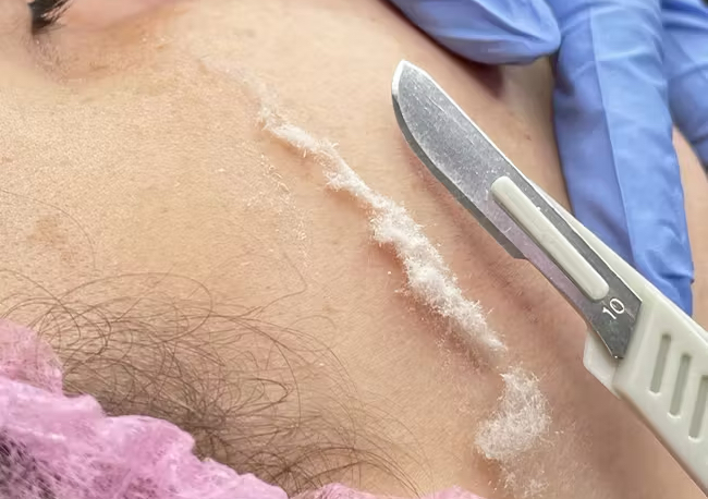 Limpieza profunda + Dermaplaning 