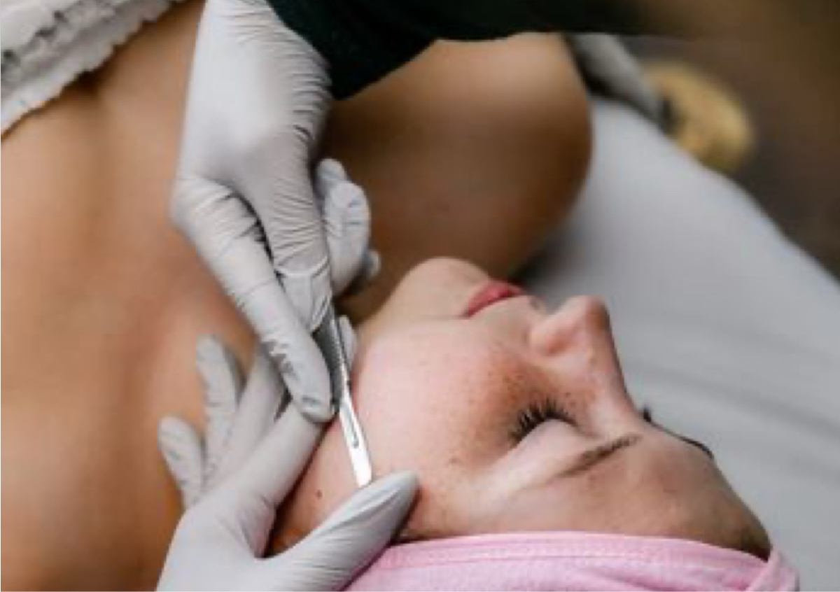 Dermaplaning