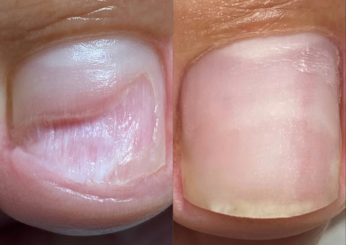 Nanoflex 2 uñas (NO incluye gel)