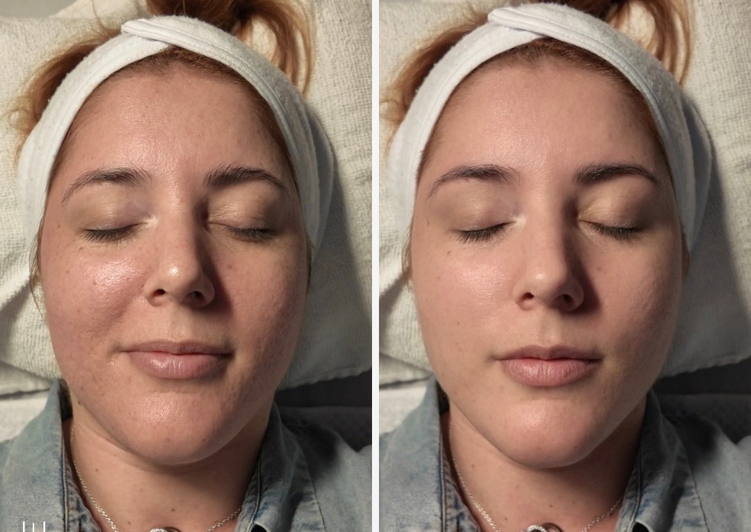 Facial de limpieza profunda