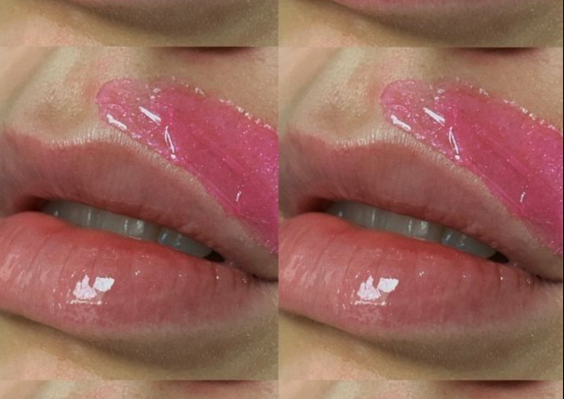 Depilación De Barbilla Y Bigote