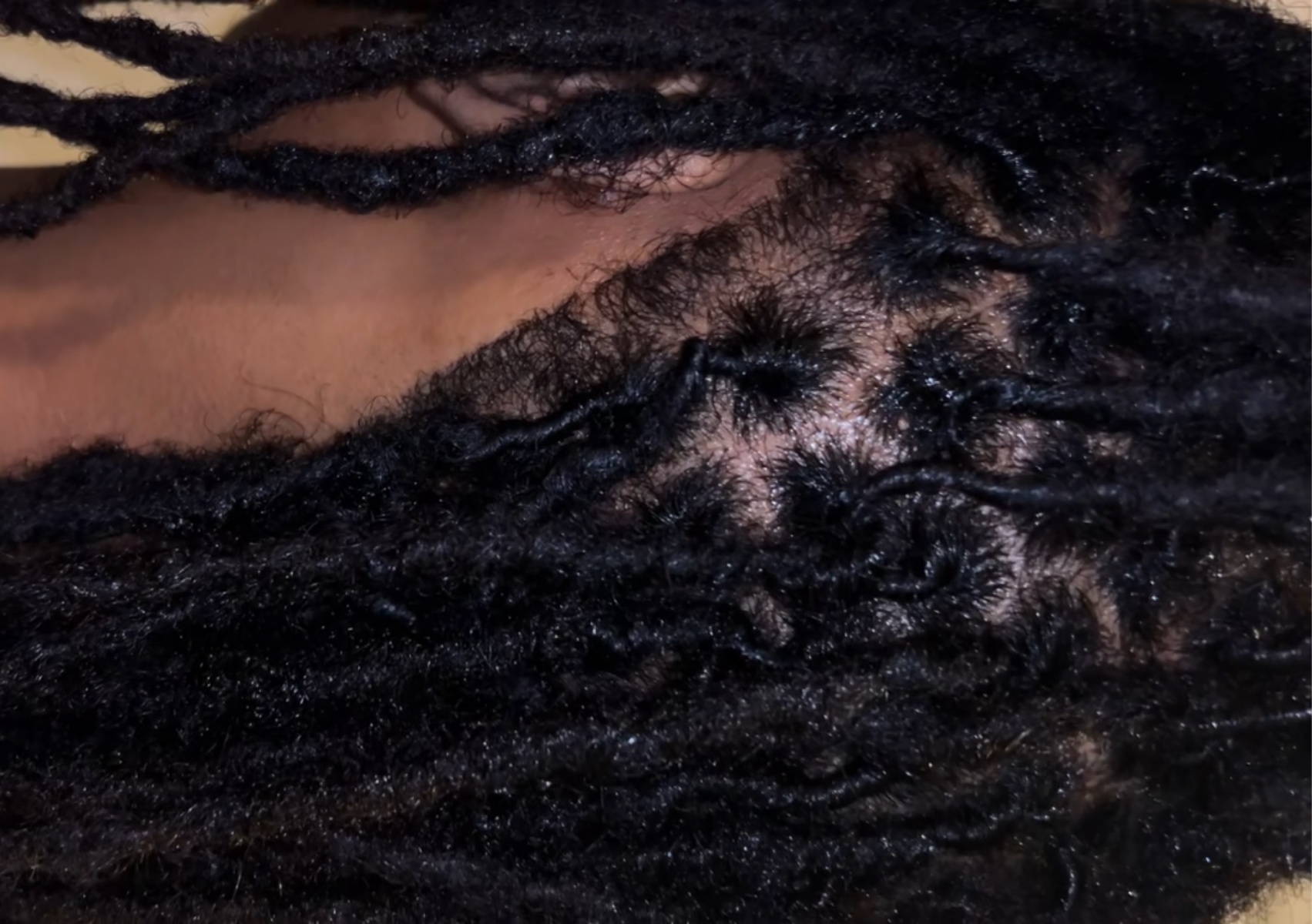 Retwist