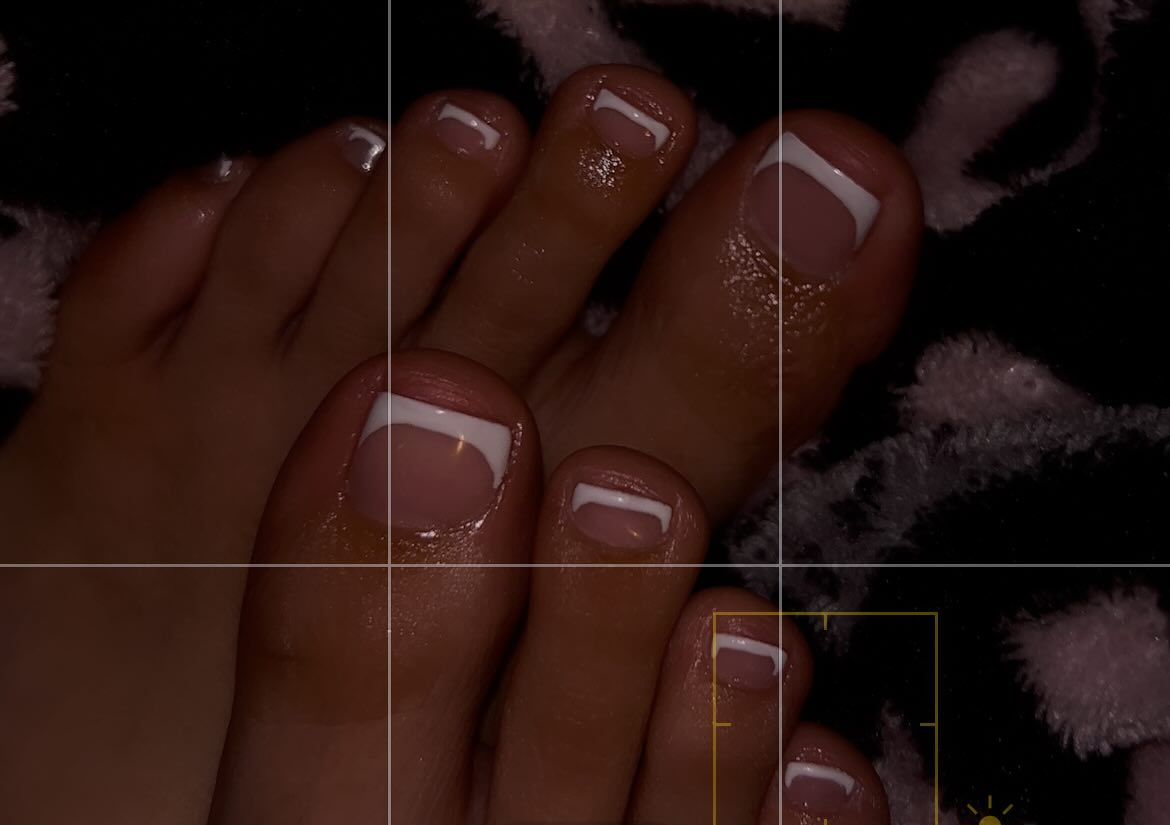 Gel Toes - Dry