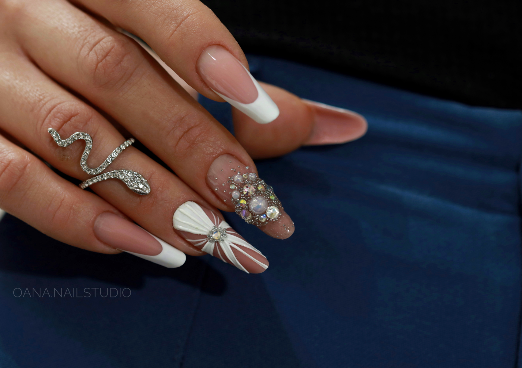 RICOSTRUZIONE MANDORLA RUSSA