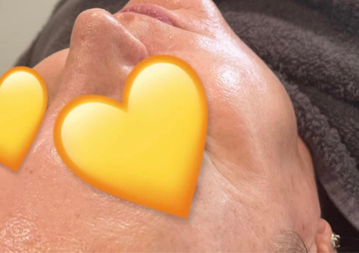 Luxury Dermaplane Facial- £5 off 