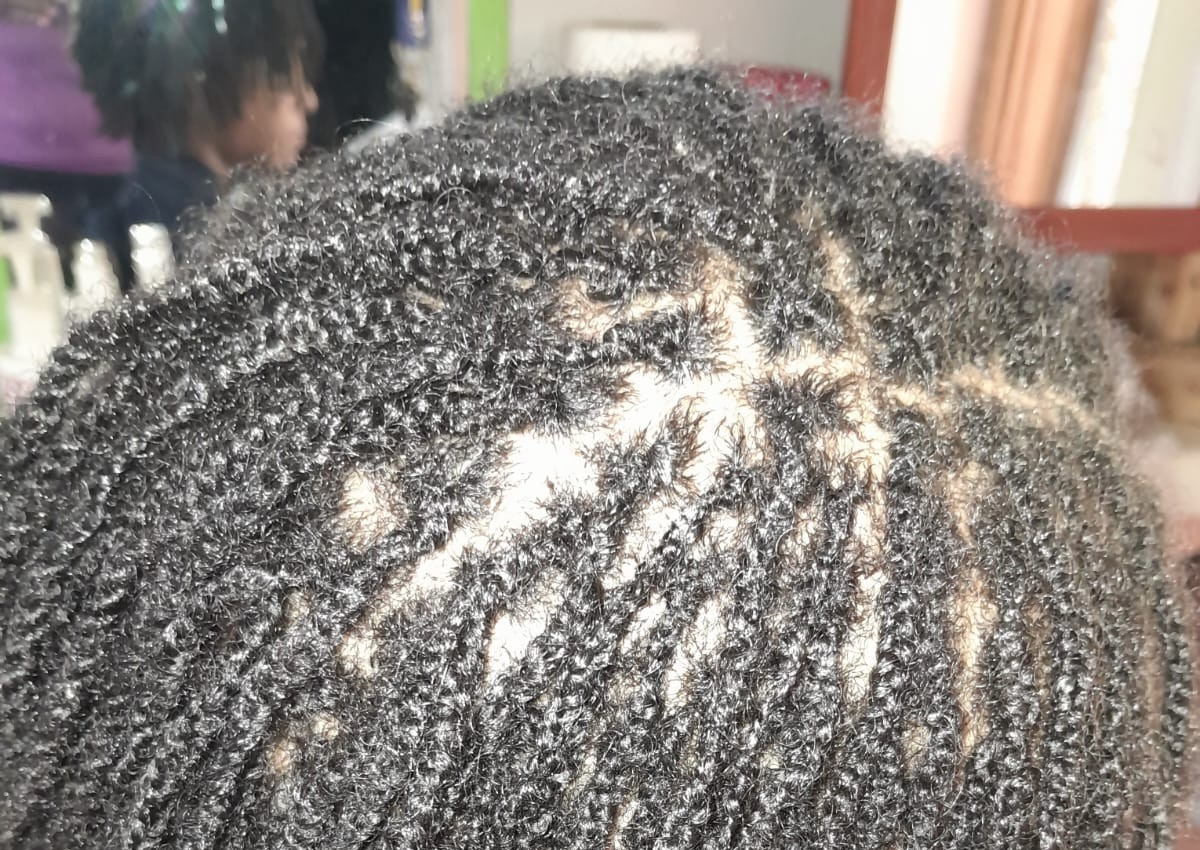 Miccrolocs retighting (interloc)