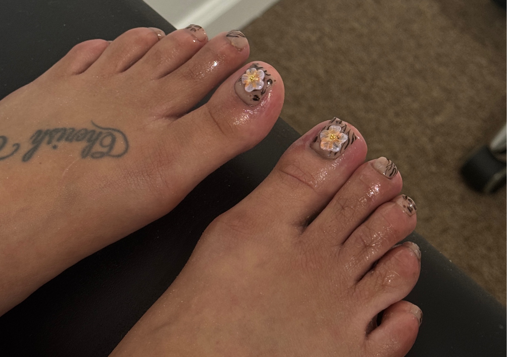 Medical Toe BBL  “Extreme fungus ” 