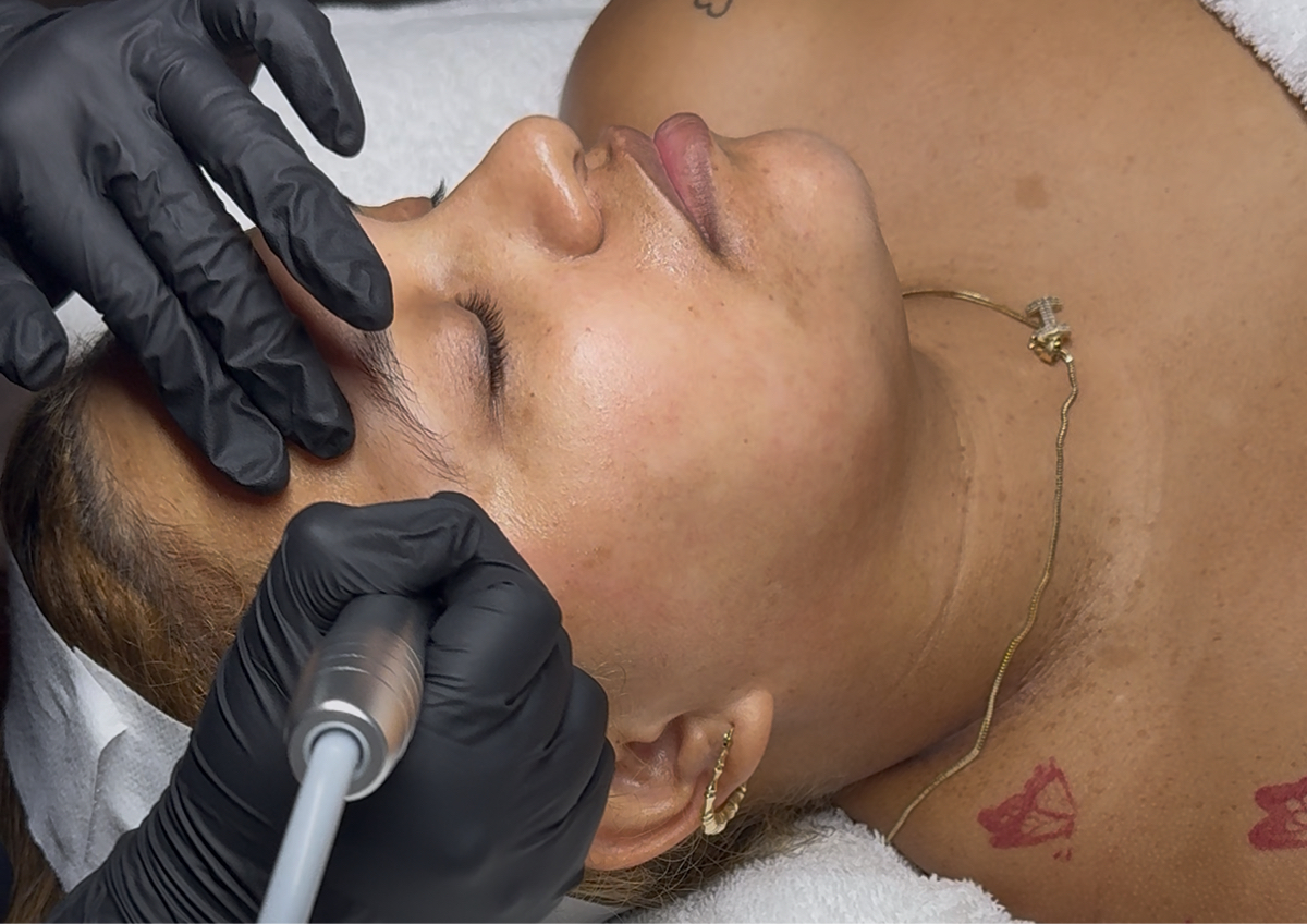 Hydrodiamond Facial 