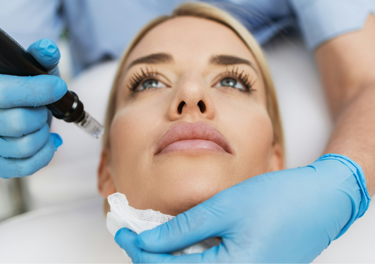 (Collagen Induction) Microchanneling 