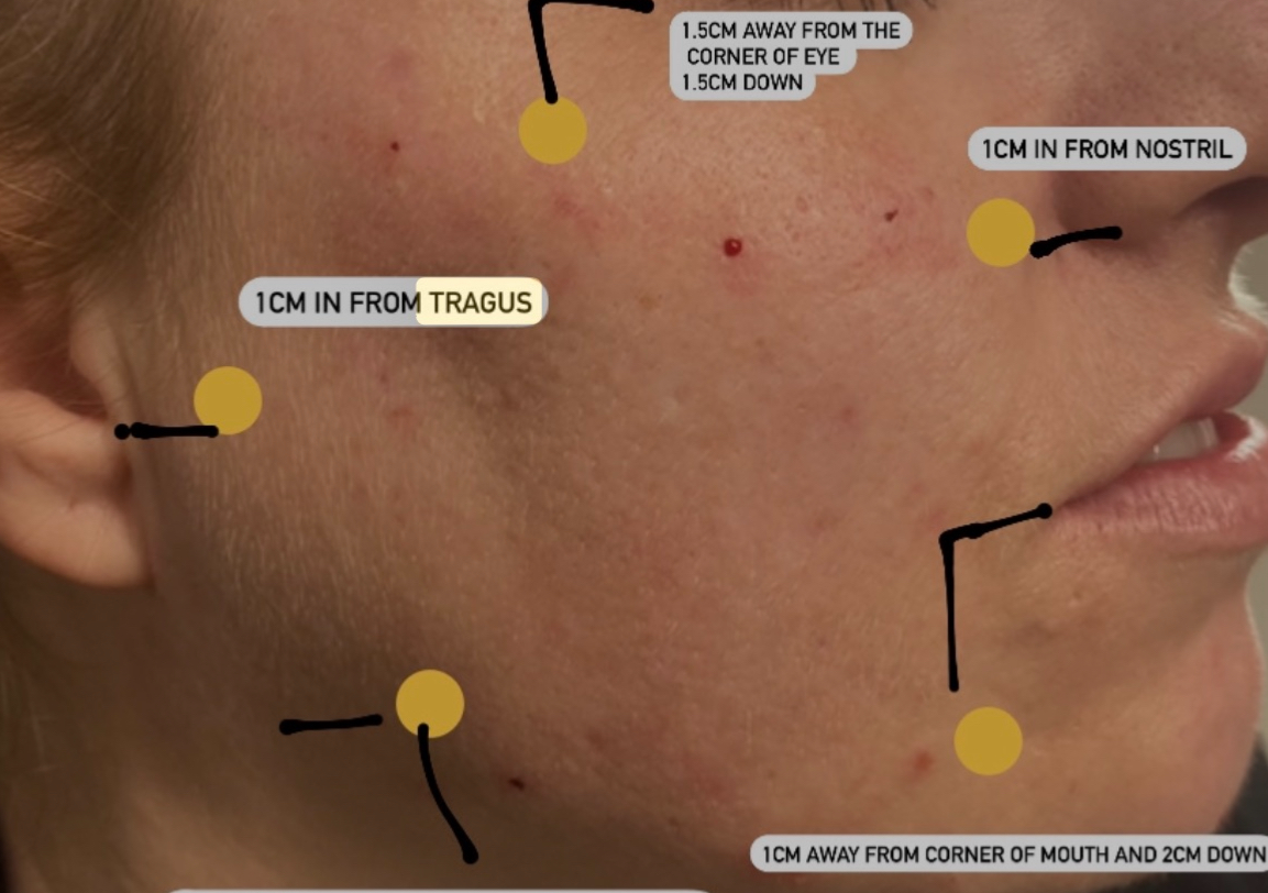 Lumi-Pro Skin / Neck Booster 