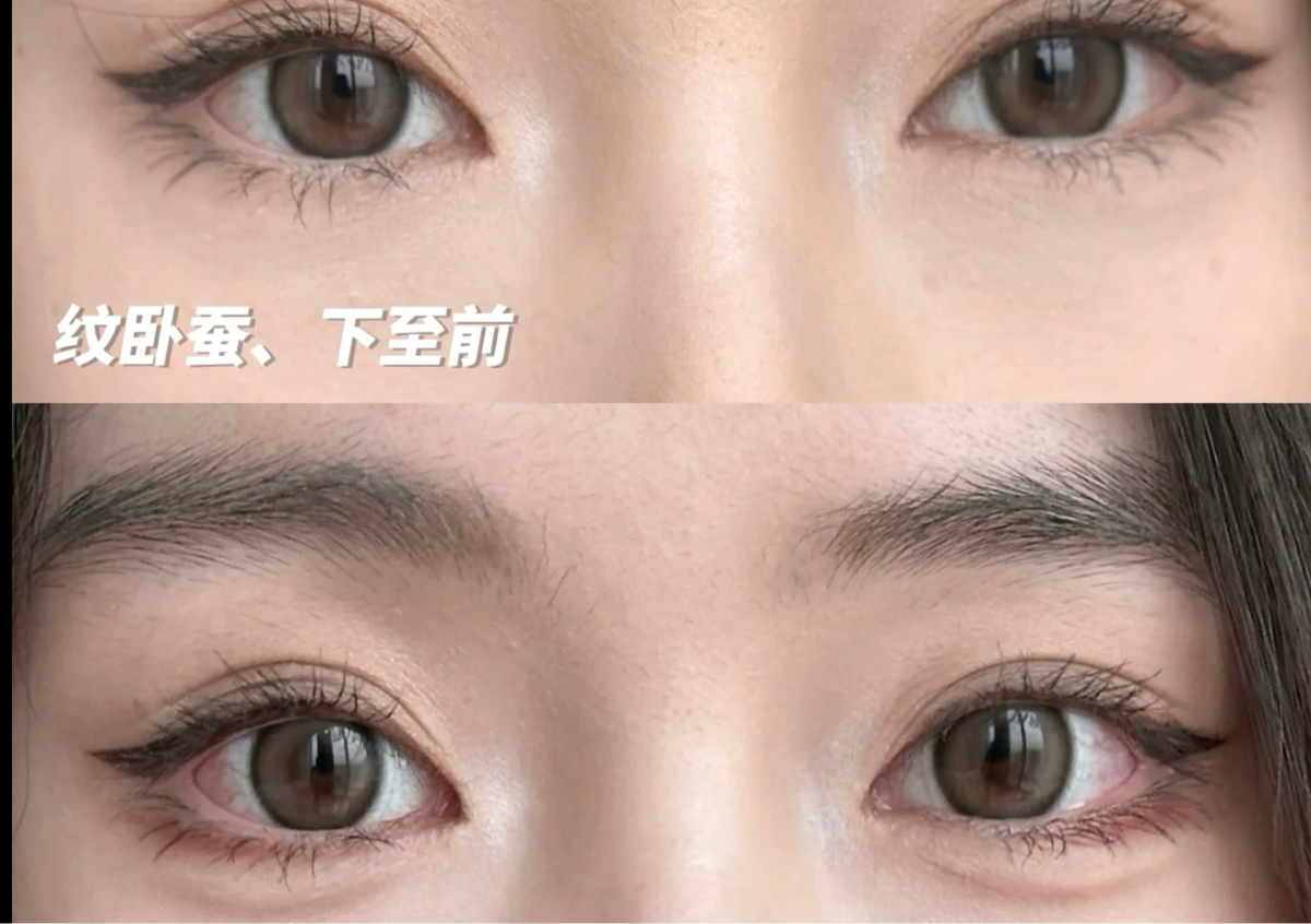 Aegyo-sal Tattoo纹卧蚕