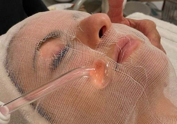 Acne Corrective Facial