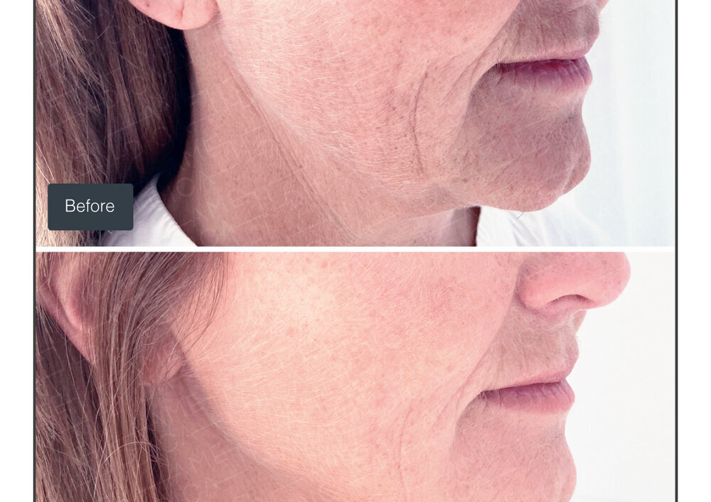 Vitaran Eyes Polynucleotides