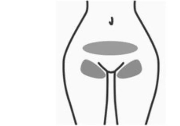 Bikini wax