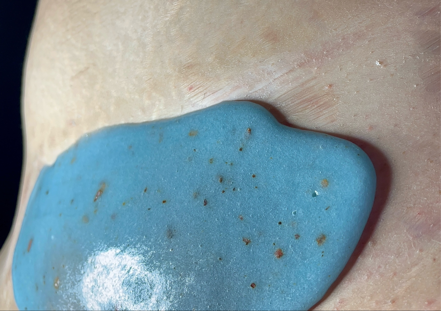 Mascarilla hidrogel luego de el brazilian Wax