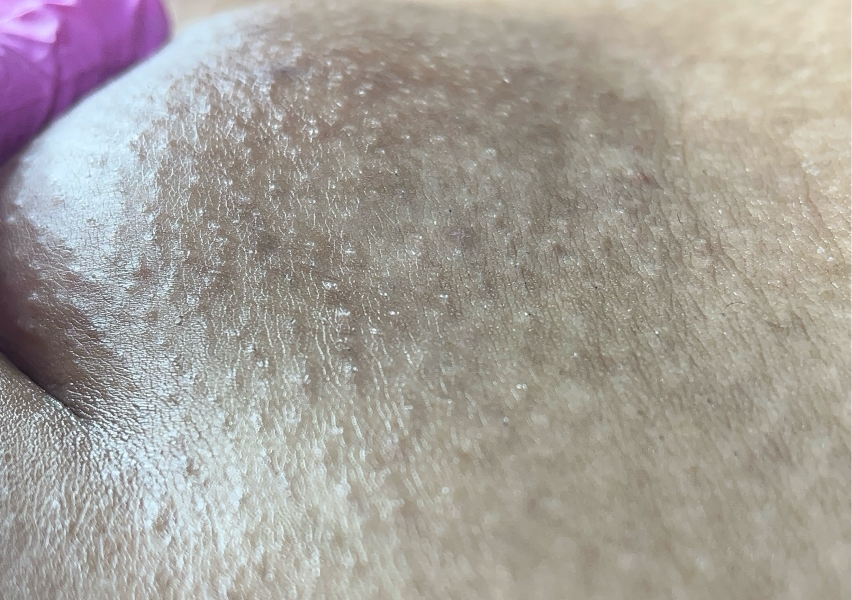 Brazilian Wax First time