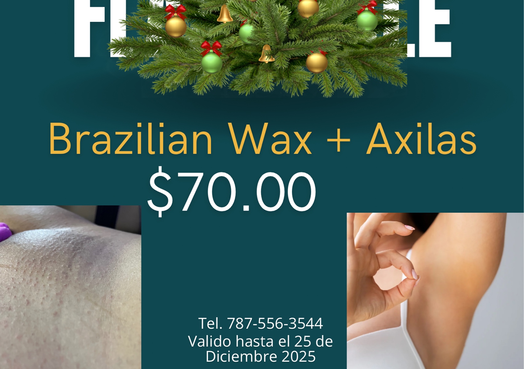 Brazilian wax + Axilas Free