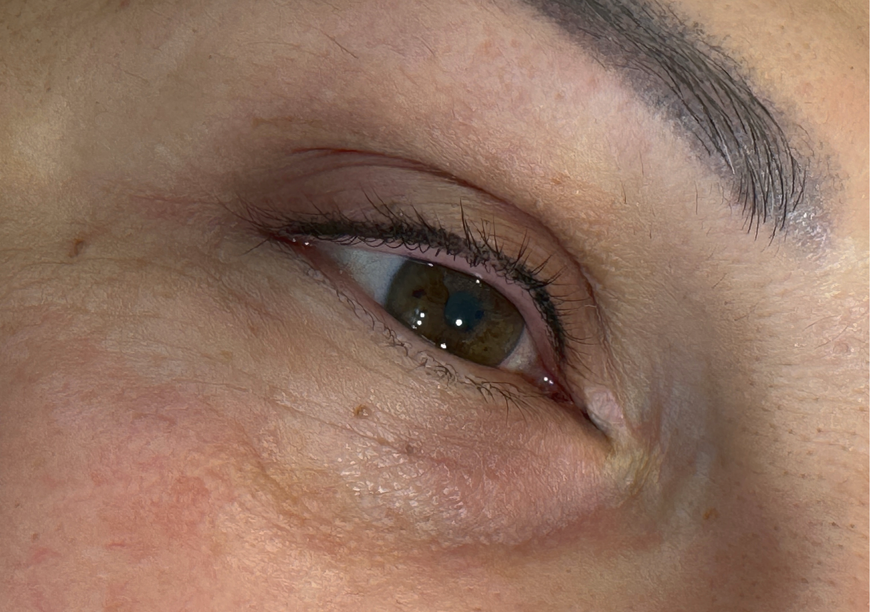 Dermopigmentazione infracigliare 