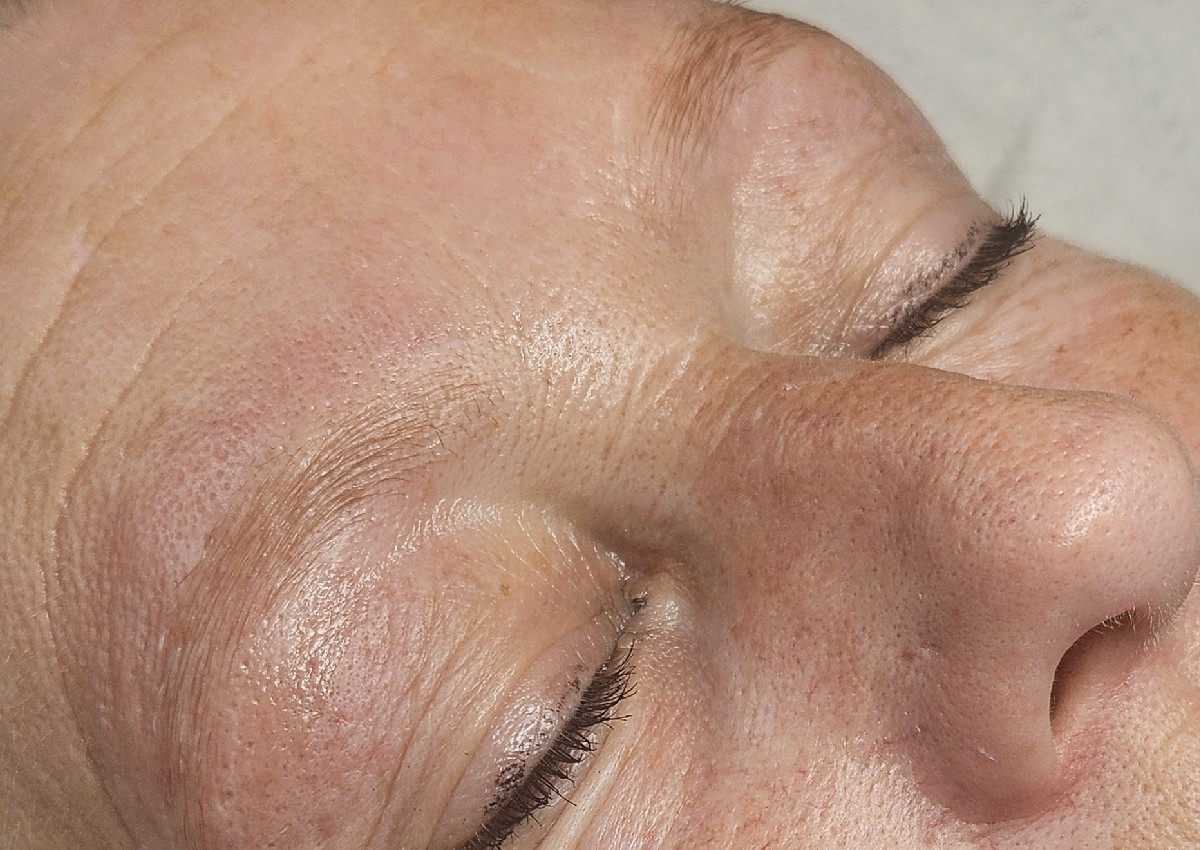 Brow Lamination (2/2)