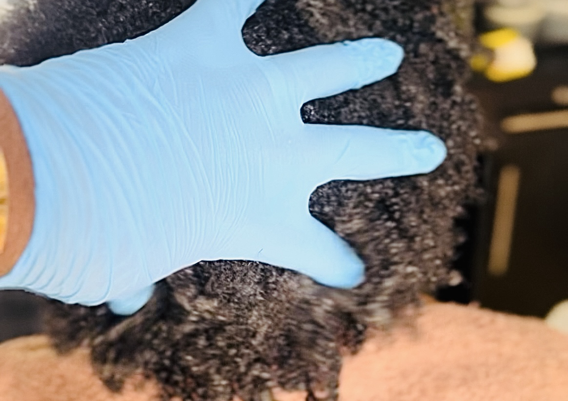 DREADLOC- Treatments