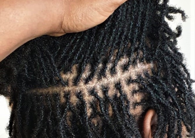 Sister Locs Consultation
