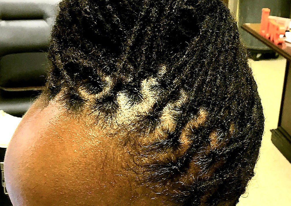 Loc Interlock & Style