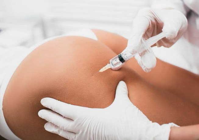 MESOTERAPIA AUNMENTO Y REAFIRMACION DE GLUTEOS 