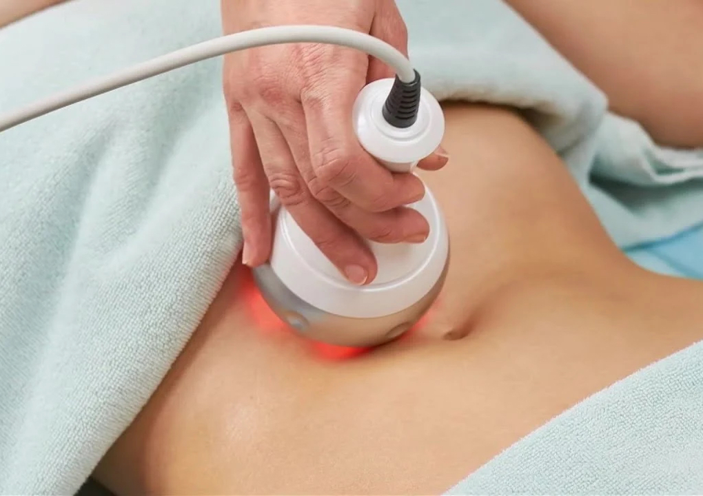 POST-OPERATORIO CORPORL ETAPA 3